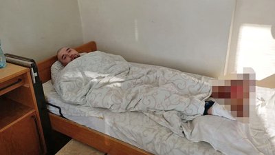 У лікарні Луцька чоловіка готують до ампутації через обмороження ніг У лікарні Луцька чоловіка готують до ампутації через обмороження ніг