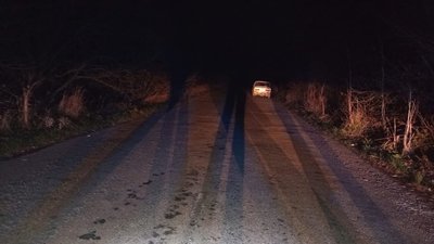 З травмами госпіталізували до лікарні: на Житомирщині автомобіль наїхав на 14-річну дівчину З травмами госпіталізували до лікарні: на Житомирщині автомобіль наїхав на 14-річну дівчину