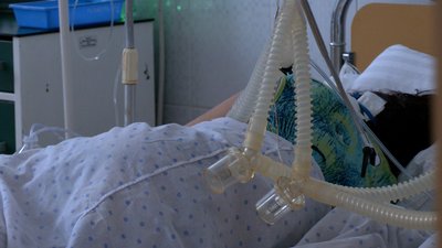 За три дні – тотальне ураження: як виглядають рентгенівські знімки легенів пацієнтів з COVID-19 За три дні – тотальне ураження: як виглядають рентгенівські знімки легенів пацієнтів з COVID-19