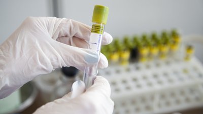 За добу на Сумщині підтвердили три нові випадки інфікування коронавірусом