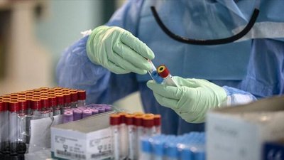 На Херсонщині за добу зафіксували 54 нові випадки захворювання на COVID-19