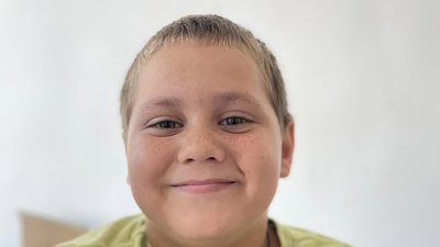 У Львові хірурги разом з колегами з США прооперували трьох дітей У Львові хірурги разом з колегами з США прооперували трьох дітей