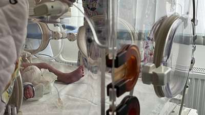 Дитина у реанімації, немовля, Тернопіль, 15 січня 2026 року
