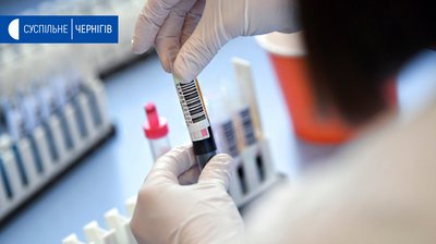 На Чернігівщині за добу 1 підтверджений випадок коронавірусу