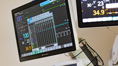 У лікарні Дніпропетровщини привезли 400 одиниць нового медичного обладнання