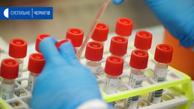 На Чернігівщині за добу - рекордна кількість нових хворих на коронавірус
