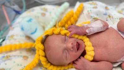 Львів'ян просять подарувати в'язаних восьминогів передчасно народженим дітям Львів'ян просять подарувати в'язаних восьминогів передчасно народженим дітям