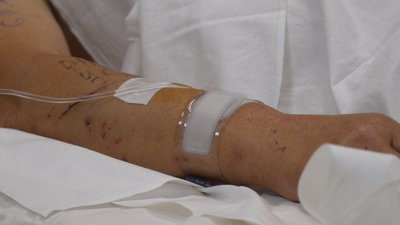 Рука однієї з поранених внаслідок удару по Яровій на Донеччині
