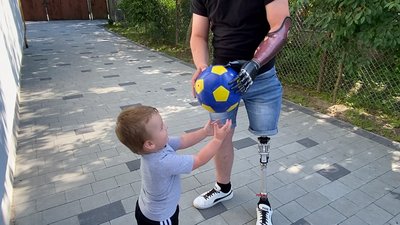 Кермує мотоциклом на двох протезах: у Львові військовому встановили біонічний протез Кермує мотоциклом на двох протезах: у Львові військовому встановили біонічний протез