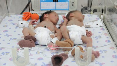 "Важко дивитися, коли задихається вагітна". Як працює ковідне відділення перинатального центру Одеси