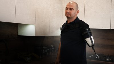 Ветеран, ампутація, війна, Франківщина