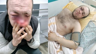 Орест Паньків у лікарні, побиття у супермаркеті