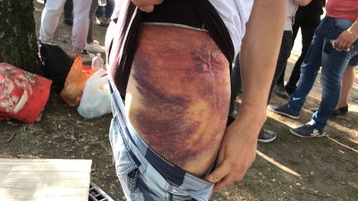 "Били до втрати свідомості". Затримані на протестах у Білорусі розповіли про катування "Били до втрати свідомості". Затримані на протестах у Білорусі розповіли про катування