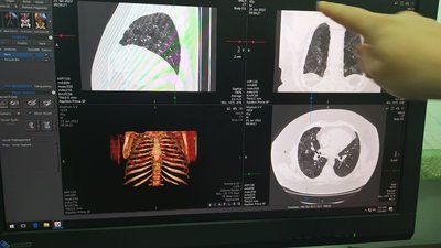 Безкоштовна комп'ютерна томографія: де зробити у Дніпрі Безкоштовна комп'ютерна томографія: де зробити у Дніпрі