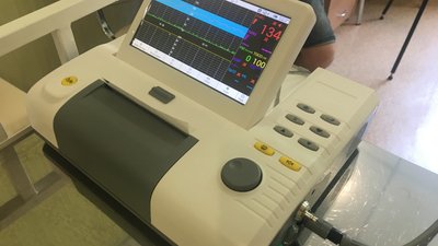 Дистанційне відстеження стану плоду у вагітних: як це працює на Полтавщині