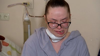 Міна впала на подвір’я: подружжя чернігівців, які потрапили під артобстріл, лікуються у Києві Міна впала на подвір’я: подружжя чернігівців, які потрапили під артобстріл, лікуються у Києві