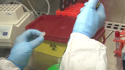 За 2020 рік в Тернопільському лабораторному центрі методом ПЛР обстежили понад 155 тисяч осіб