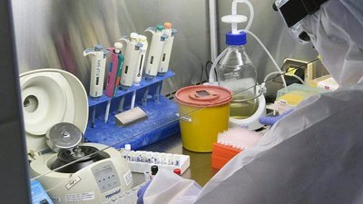 За добу захворювання на COVID-19 підтвердили у 174 мешканців Одещини
