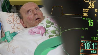 Як чернігівець живе на апараті ШВЛ, коли немає світла