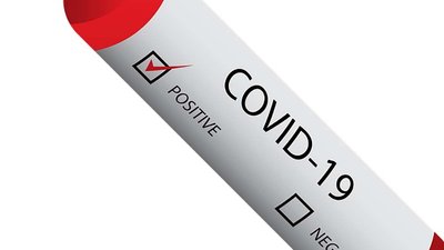 За добу на Житомирщині зареєстрували 482 випадки інфікування COVID-19
