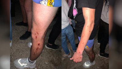 Гучно святкували: в Одесі чоловіка підозрюють у стрілянині по компанії молоді, двоє людей травмовані Гучно святкували: в Одесі чоловіка підозрюють у стрілянині по компанії молоді, двоє людей травмовані