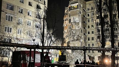 "Важка травма обличчя": 19-річну дівчину, яка була травмована внаслідок ракетної атаки по Дніпру лікуватимуть закордоном