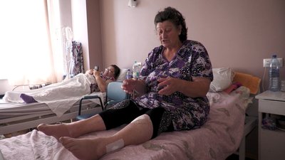У Харківській області зареєстрували перший за два роки випадок сказу людини: як почувається пацієнтка У Харківській області зареєстрували перший за два роки випадок сказу людини: як почувається пацієнтка