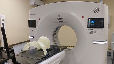 У Сумському онкодиспансері запрацював лінійний прискорювач, який дозволить точніше опромінювати пухлини У Сумському онкодиспансері запрацював лінійний прискорювач, який дозволить точніше опромінювати пухлини