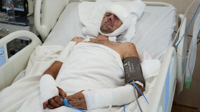 Поранений, війна, люди, Дніпро