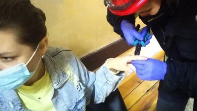 У Черкасах надзвичайники допомагали зняти дівчині каблучки з руки