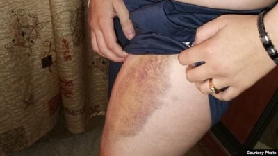 Душили та кидали у шафу. Звільнений українець заявив про катування білоруськими КДБістами