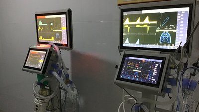 Кошти на придбання апаратів ШВЛ було виділено з районного бюджету. Фото: Хмельницька ОДА