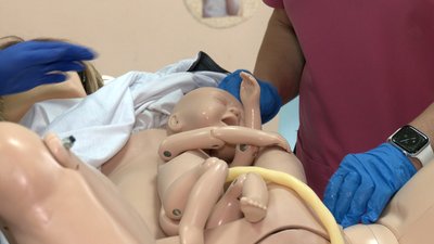 Під час пологів 10% дітей потребують реанімації Під час пологів 10% дітей потребують реанімації