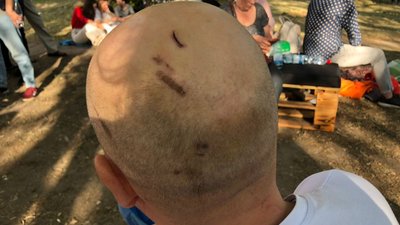 "Били до втрати свідомості". Затримані на протестах у Білорусі розповіли про катування "Били до втрати свідомості". Затримані на протестах у Білорусі розповіли про катування