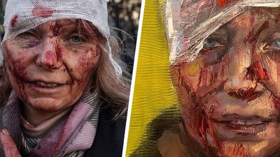 Портрет пораненої жительки Чугуєва після обстрілу РФ продали за 100 тисяч доларів