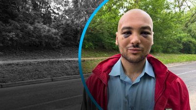 Артем Передерій був побитий у Полтаві невідомими людьми - історія хлопця