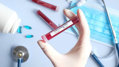За добу захворювання на COVID-19 підтвердили у 963 мешканців Одещини