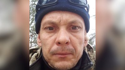 "У нього майже немає обличчя": на Дніпропетровщині лікують пораненого військового "У нього майже немає обличчя": на Дніпропетровщині лікують пораненого військового