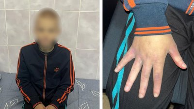 На Уманщині мати та батька підозрюють у побитті 13-річного сина