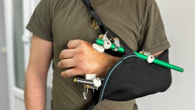 Перерізав руку бензопилою