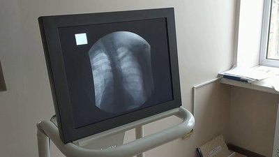 Захворюваність зменшилась на 22%