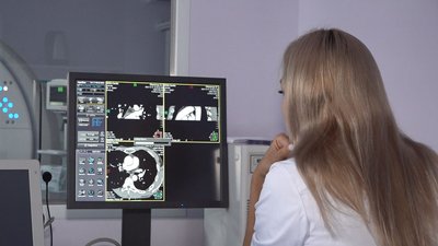 Кардіоцентр у Черкасах отримав сучасний томограф Кардіоцентр у Черкасах отримав сучасний томограф