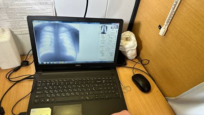 У Полтаві охочим робили обстеження легень у пересувному флюорографі: як це було