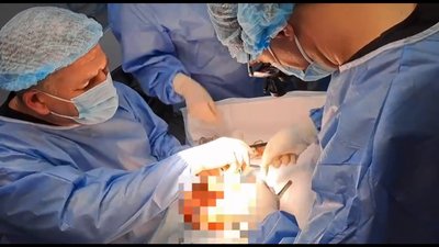 Операція із пересдки серця у Вінниці