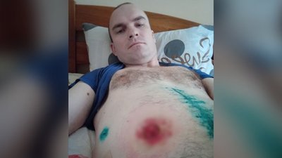 "Кацапи вже усюди ходили. Думав, що доб'ють": історія хмельницького військового, який двічі ледь не загинув "Кацапи вже усюди ходили. Думав, що доб'ють": історія хмельницького військового, який двічі ледь не загинув
