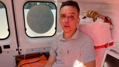 У Чернівцях посеред вулиці побили чоловіка. Нібито через дописи у соцмережах