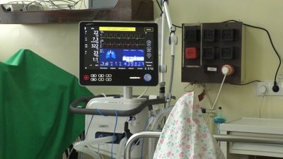У Сумах 18 пацієнтів із COVID-19 перебувають на штучній вентиляції легень