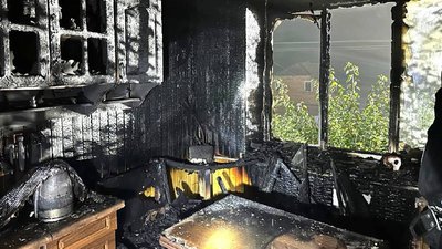 На пожежі в квартирі двоповерхівки на Житомирщині врятували 49-річного чоловіка: потерпілий з опіками в лікарні