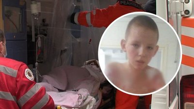"Сам їсть, сидить, пробує вставати на ноги". Мама хлопчика з опіками з Кіровоградщини