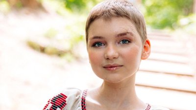 Дівчинка, яка поранила обличчя під час обстрілу у Чугуєві, готується до другої пластичної операції Дівчинка, яка поранила обличчя під час обстрілу у Чугуєві, готується до другої пластичної операції